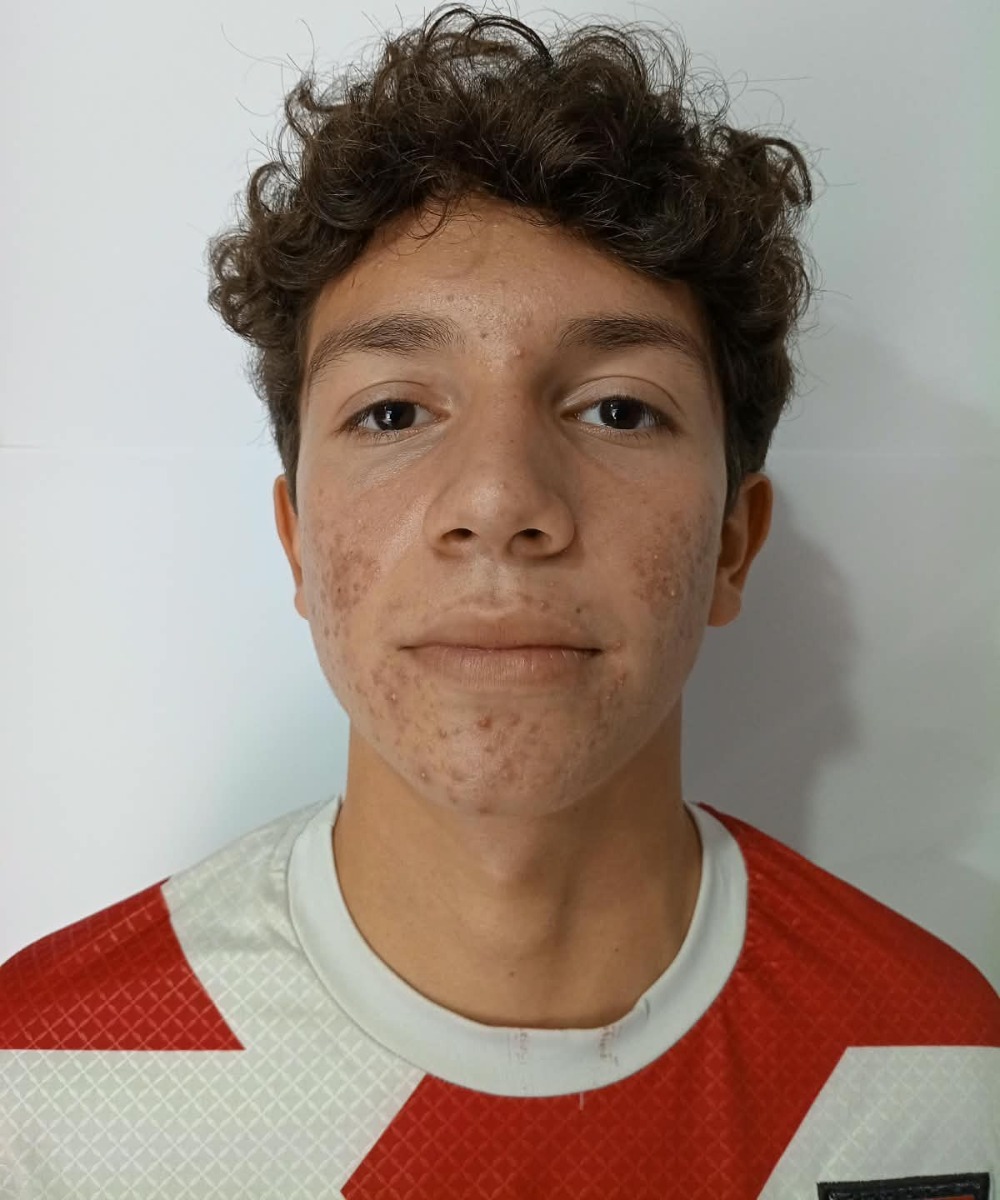 Fotografía de Johan Yaret Nuñez Contreras